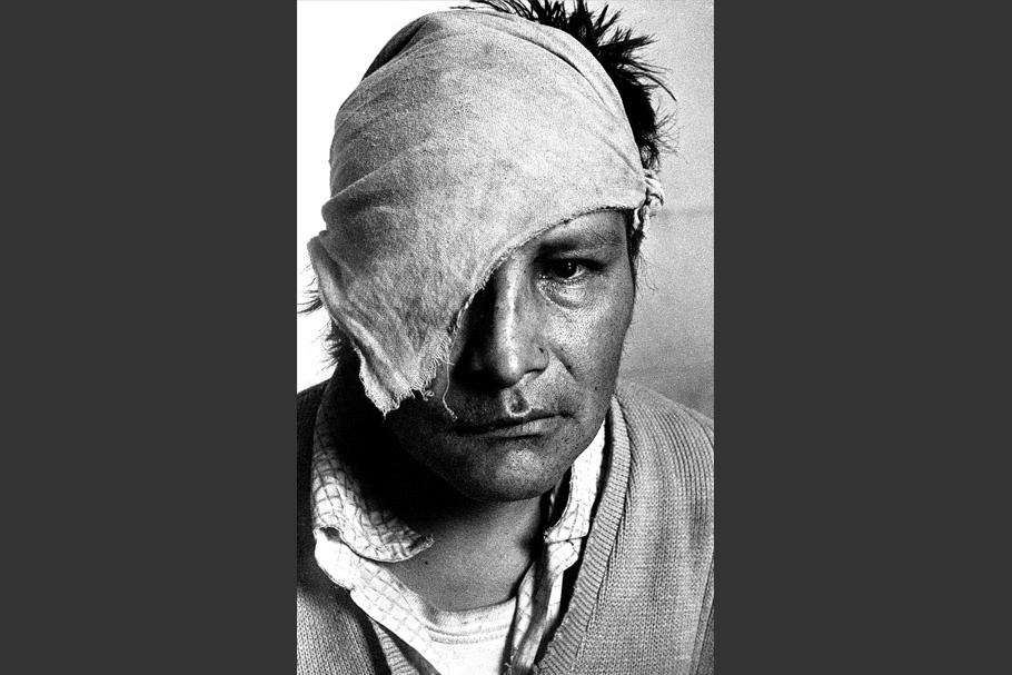A Portrait of a wounded man.